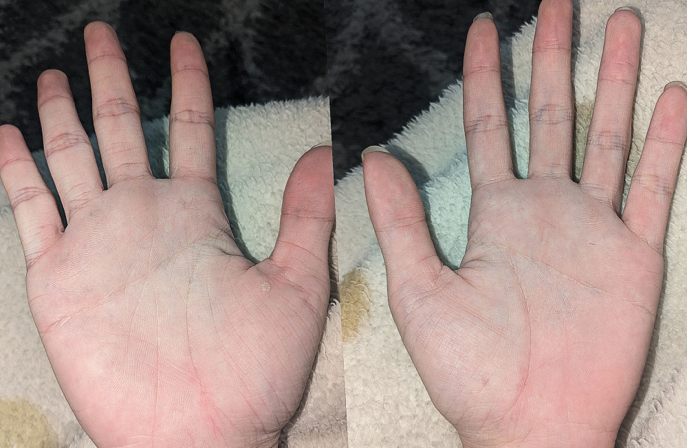手相を占って欲しいです！ 最近占いに興味があるのですが手相の見方がよく分からないのでどなたか見ていただけないでしょうか 基本性格 適職例 健康面 恋愛面など分かることがあったらなんでも教えて欲しいです どなたか知恵をお貸しください