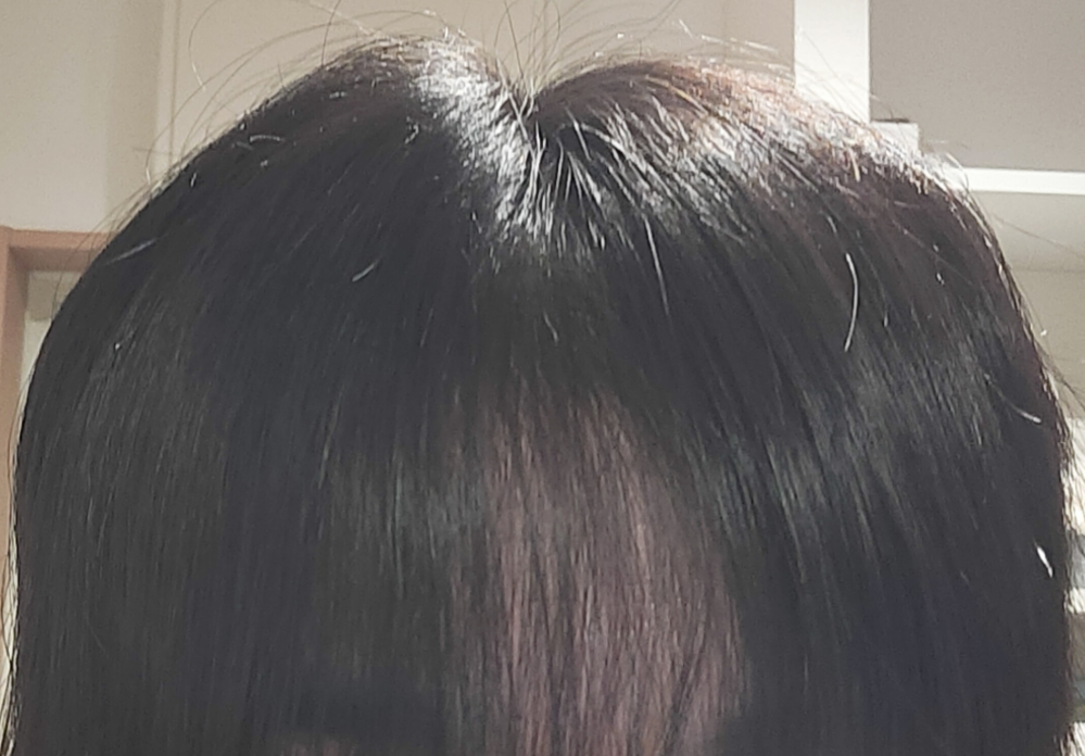 高校生なのですがこれは薄毛ですか？ 突然ヘアアイロンして全部髪伸ばしたら1部分だけ天然シースルーみたいになってしまっていました ※元々くせ毛です