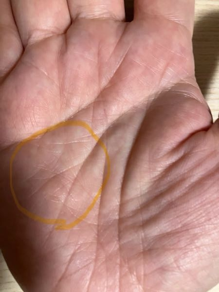 手相を見てください。マーキングしたところが黒くなってるのですが