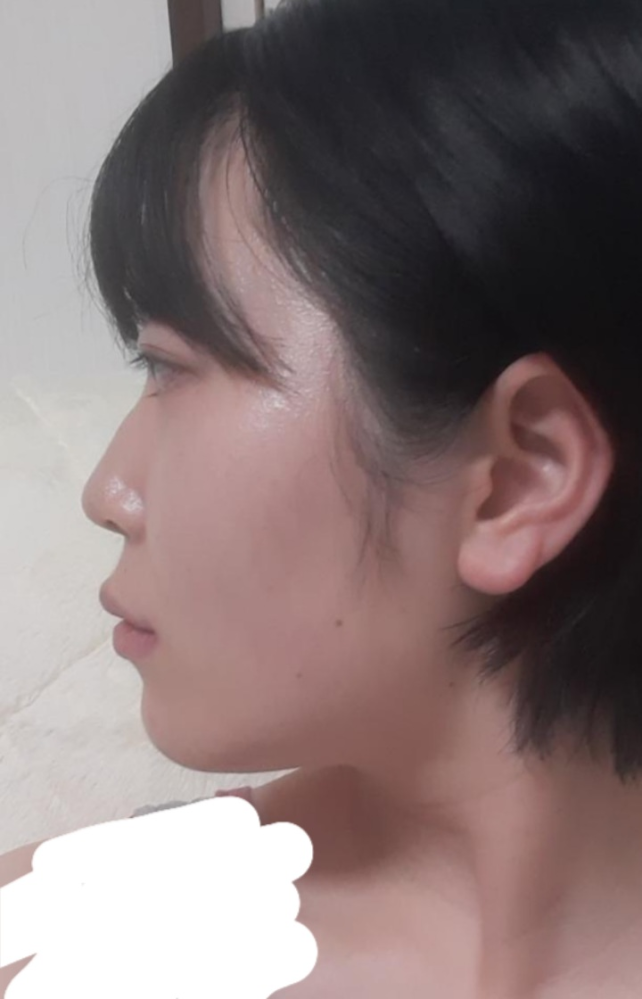 横顔の評価をお願いします。これ見て可愛いと感じますか？1.はい