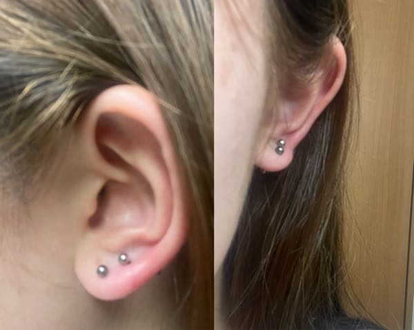 ピアスを片耳に二つ開けてみたのですがこの位置はおかしいでしょ