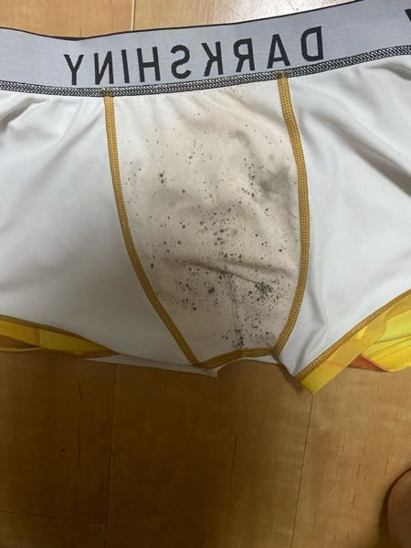 下着にカビのような黒い点々がたくさん付いていて、いくら洗濯を