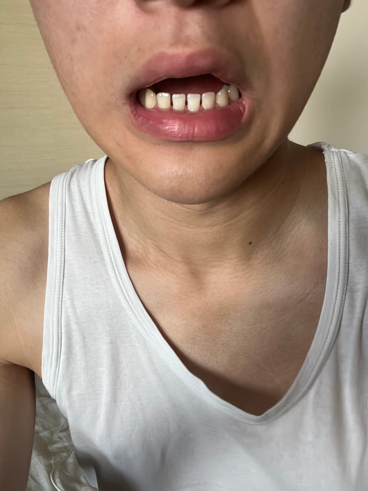 すきっ歯 hq720.jpg?sqp=-