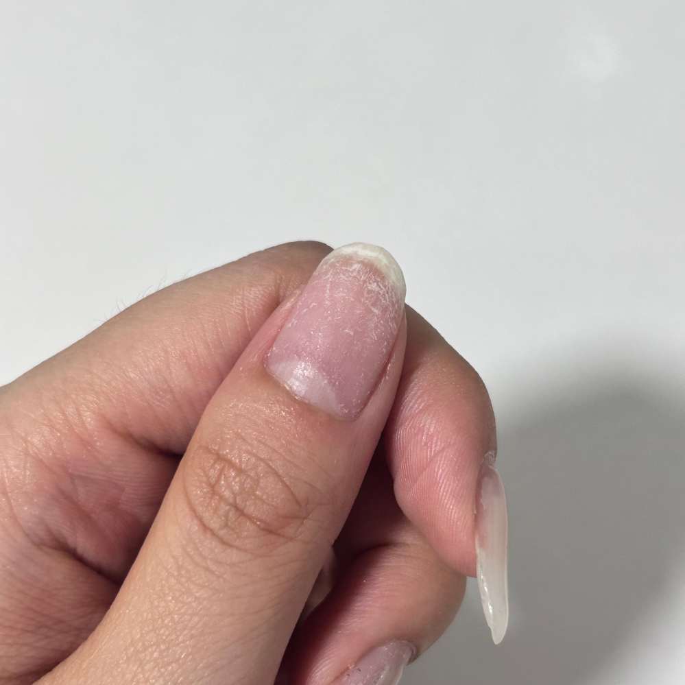 ジェルネイルをオフした後必ず写真のように白く、ひび割れたような爪？にな... - Yahoo!知恵袋