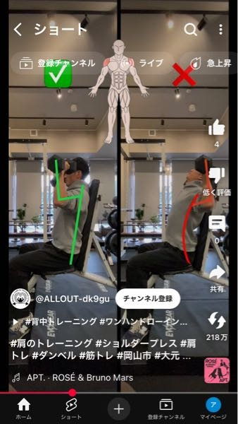 筋トレでトラブルの質問です バーベルを持ちベンチに座りショルダープレスをしました。 何故かベンチ80°くらいに座り上腕を顔の真横にと考えバーベルを上げ下げしました。 肩の前部を痛めました。 そこまで痛くはないですが整体に行くか悩んでいます 怪我の損傷は何という名前でしょうか？ 画像を添付しますが、画像の右のような感じで背中はベンチにつけてバーベルと言った感じです。 本当に回答お願いいたします。