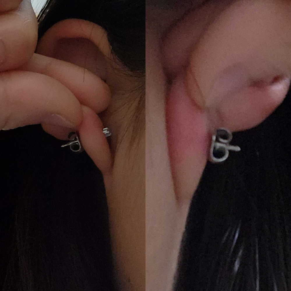 5日前にピアスを開けました。ピアスの後ろのバタフライ？なんと 