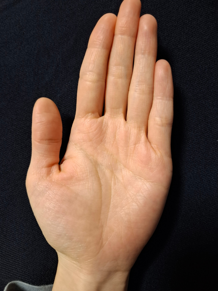 手相を見て頂きたいです。 左手の生命線が短く、運命線に島が見えるのが気になります。 詳しい方、鑑定をよろしくお願いします。