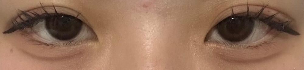 ※肌汚いです。お見苦しくてすみません。 これは地雷メイクできてますか？変なところありますか？地雷系のお姉様方にアドバイスいただきたいです。