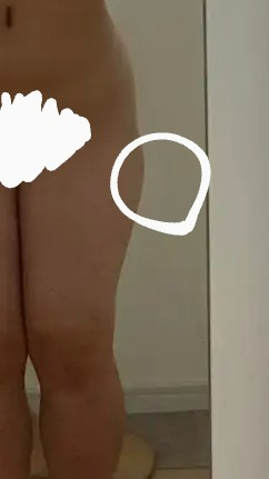 画像注意です。 ◯のところの膨らみを落とす方法を教えてください。