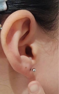 ファーストピアス開けたんですが、これって成功ですか？？耳たぶ