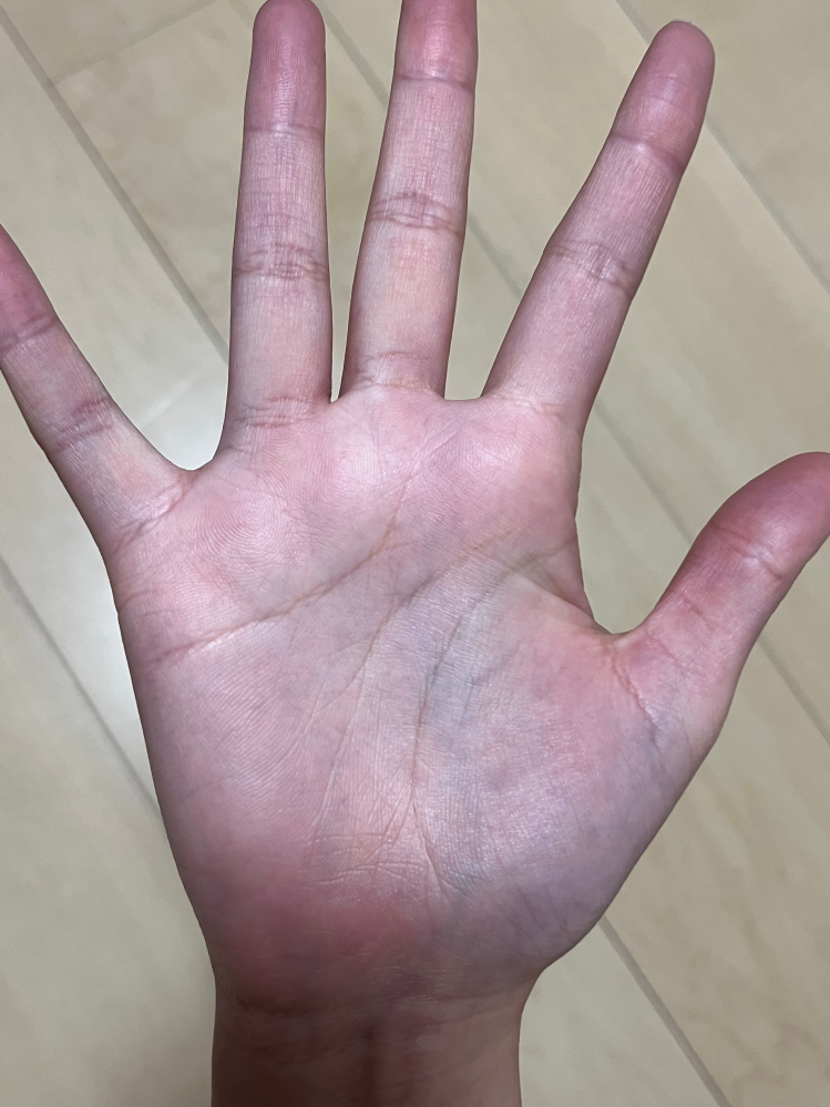 手相を見てもらいたいです。今年19歳になります。特に将来の事と結婚に