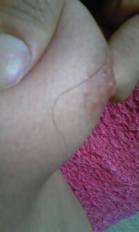 この写真の乳毛長いですか 男です 並よりはやや長めですね Yahoo 知恵袋