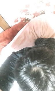 画像は薄毛でしょうか つむじから前頭部にかけて分け目が延長 Yahoo 知恵袋