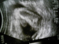 妊娠30週の時のエコー写真です 足の間にある丸いものは睾丸ですかぁ 睾 Yahoo 知恵袋