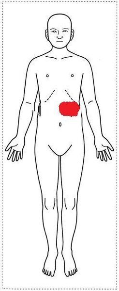 脇腹から背中の痛み