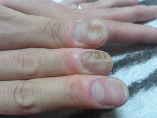 ガタガタな爪は ネイルできますか 画像のようなガタガタ Yahoo 知恵袋