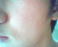 23才の男ですが 自分の肌に自信がありません しかし友達や家 Yahoo 知恵袋