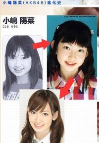 整形 小嶋 陽 菜