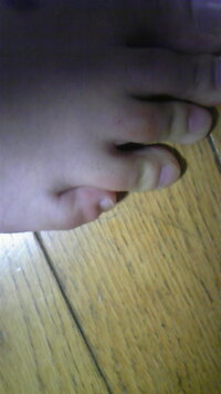 寝ている時 特に寝入りばな足がびょんっ と跳ね上がる事はないですか 私は Yahoo 知恵袋