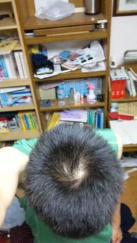 18歳男です2cmの坊主にして蛍光灯の下で撮ったんですが つ Yahoo 知恵袋