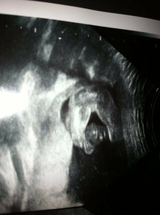 妊娠6ヶ月のエコー写真です 性別はどっちですか 分かる方お願いします Yahoo 知恵袋