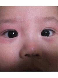 新生児 ３ヶ月 の目のふちが赤いこんばんは もうすぐ３ヶ月になる赤 Yahoo 知恵袋