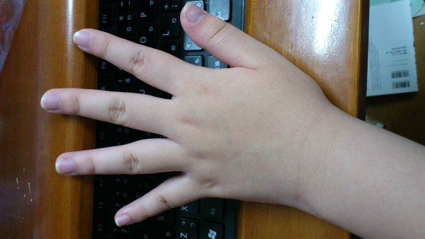 指が太っているのがコンプレックスです 友達によく 赤ちゃんみたい Yahoo 知恵袋