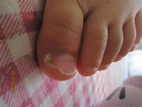 足の爪は病院の何科にみてもらえばいいですか 1歳半の子 Yahoo 知恵袋