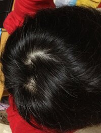 高校生です最近つむじのあたりが気になります これはハゲてきているのでし Yahoo 知恵袋