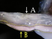 寄生虫 精子 イカわた料理に透明で細長いものを発見しました Yahoo 知恵袋