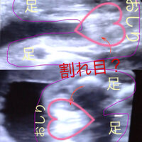 8ヶ月になったのに 赤ちゃんはいつも行儀正しく 足を閉じたり Yahoo 知恵袋