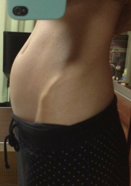 妊娠初期の胃下垂と下腹部の膨らみ 現在 妊娠11w1dで嘔吐はないも Yahoo 知恵袋