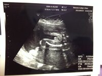 妊娠28週 性別についてです 妊娠28wの初妊婦です 私 Yahoo 知恵袋