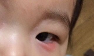 エイリアン 津波 背の高い 赤ちゃん 目やに 腫れ Hana Mochi Jp