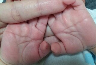赤ちゃんのマスカケ線について生後1ヶ月の赤ちゃんですが 手相を Yahoo 知恵袋 赤ちゃんのマスカケ線について生後1ヶ月の赤ちゃんですが 手相を Yahoo 知恵袋