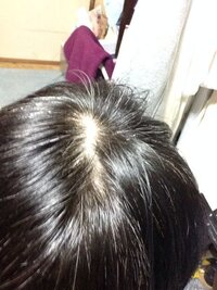 横からつむじを撮ったらこんな風になってたんですがこれって禿げて Yahoo 知恵袋
