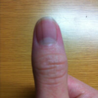 実は ずっと気になってたんですが私の右手の親指の爪に黒い線がついているん Yahoo 知恵袋