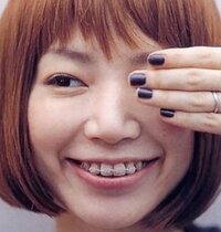 女性に質問です 矯正をしてる男の人と付き合えますか 受け口なう Yahoo 知恵袋