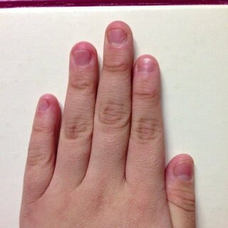 中学生2年なんですけど 爪を噛む癖が治りません やめたいです ピンクの部 Yahoo 知恵袋