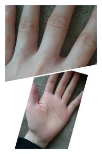 薬指 中指と小指の間だ を見たら 前まで無かったホクロがありました Yahoo 知恵袋