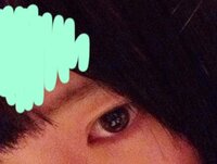 まぶたの肉 まぶたの肉を落とすには マッサージがいいと Yahoo 知恵袋