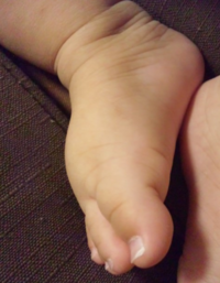 ８か月の赤ちゃんの足の甲について質問です ８か月の赤ちゃ Yahoo 知恵袋