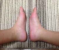 足の裏のかかとが痛いです 先日久しぶりにバスケをしてから Yahoo 知恵袋