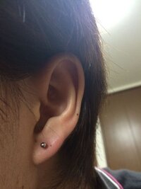 １ヶ月経ってもピアスホールから出血します １ヶ月ほど前に Yahoo 知恵袋