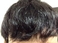 中学3年生です 私はくせ毛なので 学校へ行くときは毎朝ストレートア Yahoo 知恵袋