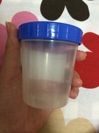 検便容器についての質問です 筒状で棒の先端に便を少量つけてキャ Yahoo 知恵袋