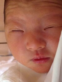 赤ちゃんの二重について 画像あり 3ヵ月になる子どもがいるのですが眠いときや寝 Yahoo 知恵袋