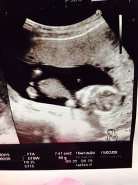 今妊娠15週目の妊婦です 今日検診に行って性別を教えていただき Yahoo 知恵袋