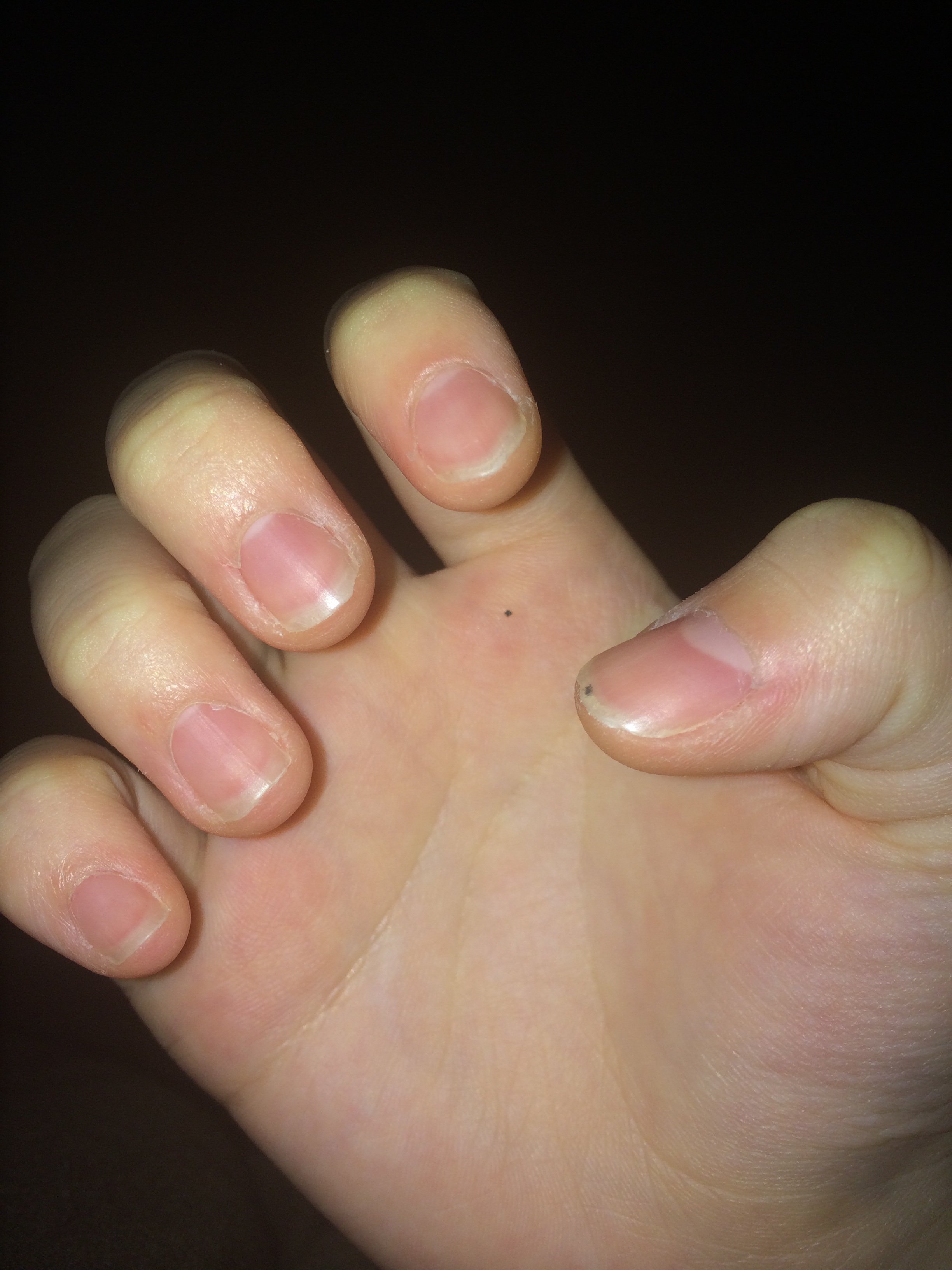 もともと爪が短いのですがジェルネイルの長さだしできますか Yahoo 知恵袋