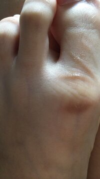足の親指に茶色の線みたいのがあるんですけどなにかわかる方います Yahoo 知恵袋